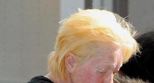 ¿Qué le ha pasado a Cyndi Lauper en la cara?