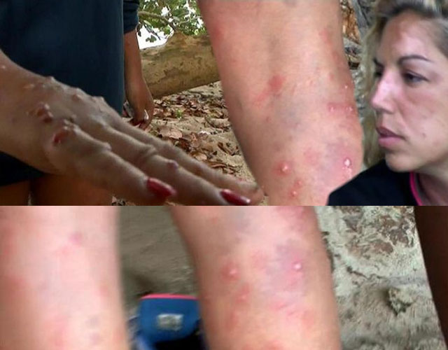 Todos los 'Supervivientes' 2014 de Playa Uva, evacuados por plaga de mosquitos