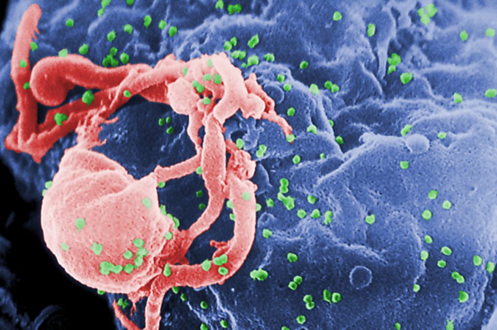 Una nueva vacuna contra el VIH 