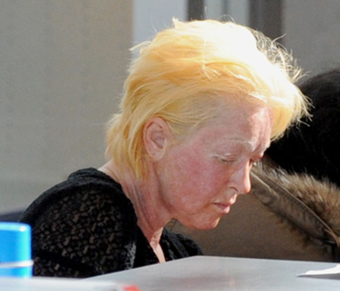 ¿Qué le ha pasado a Cyndi Lauper en la cara?