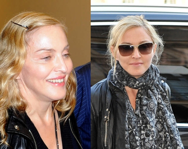 Madonna se ha hecho algo en la cara