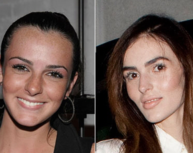 El transplante de cara de Ali Lohan, hermana de Lindsay