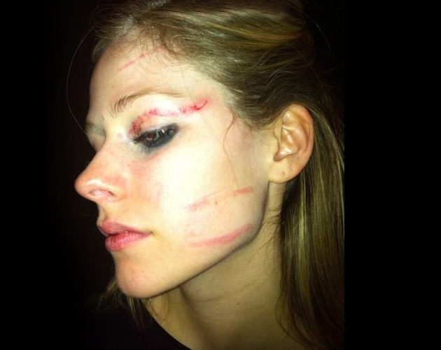 Avril Lavigne termina casi desfigurada en una pelea en un hotel