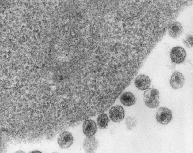 Dos personas con VIH podrían haberse curado después de un trasplante de médula