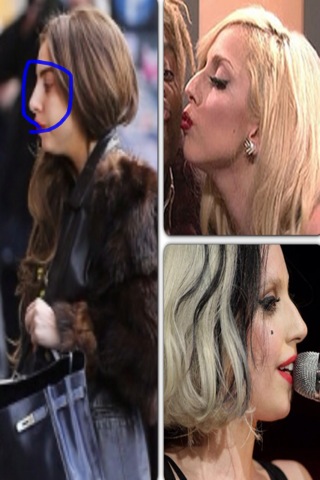 ¿Se ha operado la nariz Lady Gaga?
