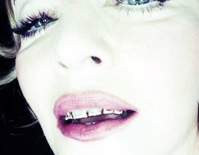 Madonna estrena dentadura... dorada