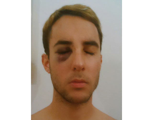 Agresión homófoba: un guarda de seguridad de Renfe ataca a un joven gay en Málaga