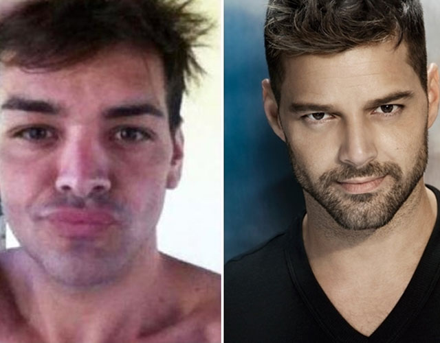 Un hombre argentino se opera para parecerse a Ricky Martin