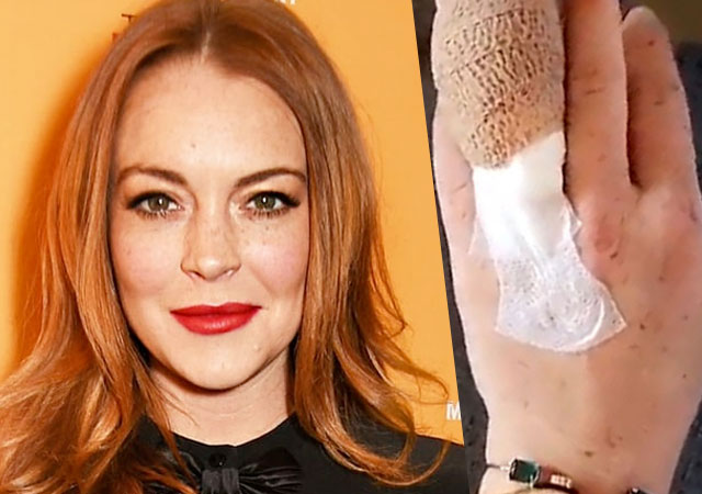 Lindsay Lohan pierde parte de un dedo en un terrible accidente