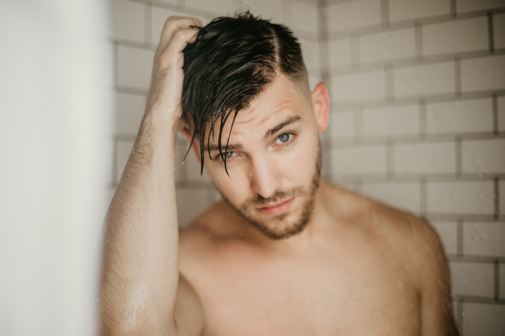 alopecia gay alopecia gay