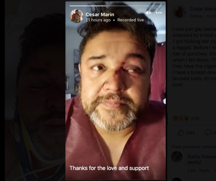 Hombre gay atacado por un grupo de 10 personas 2