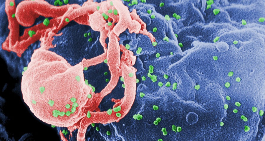 Se abandona un ensayo del VIH