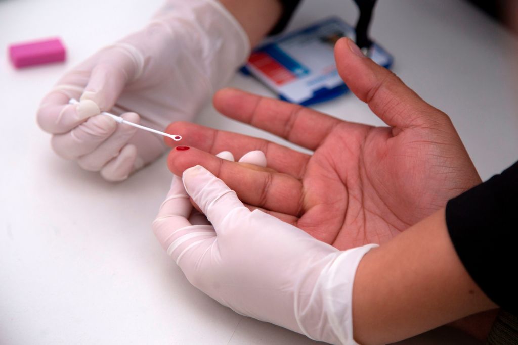 El tratamiento experimental que puede haber eliminado el VIH de un paciente