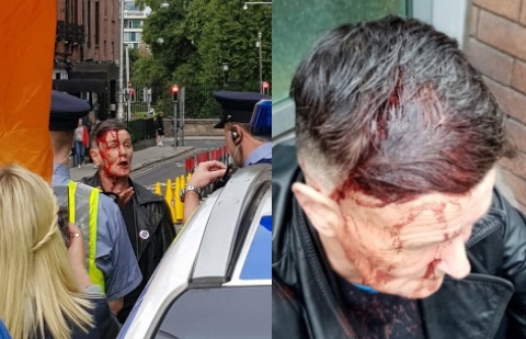 Activista LGTB golpeada Dublin