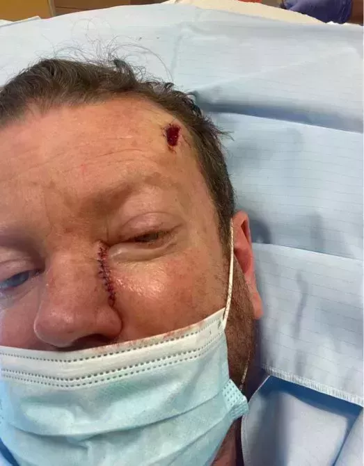 Wayne G undergoes treatment for skin cancer