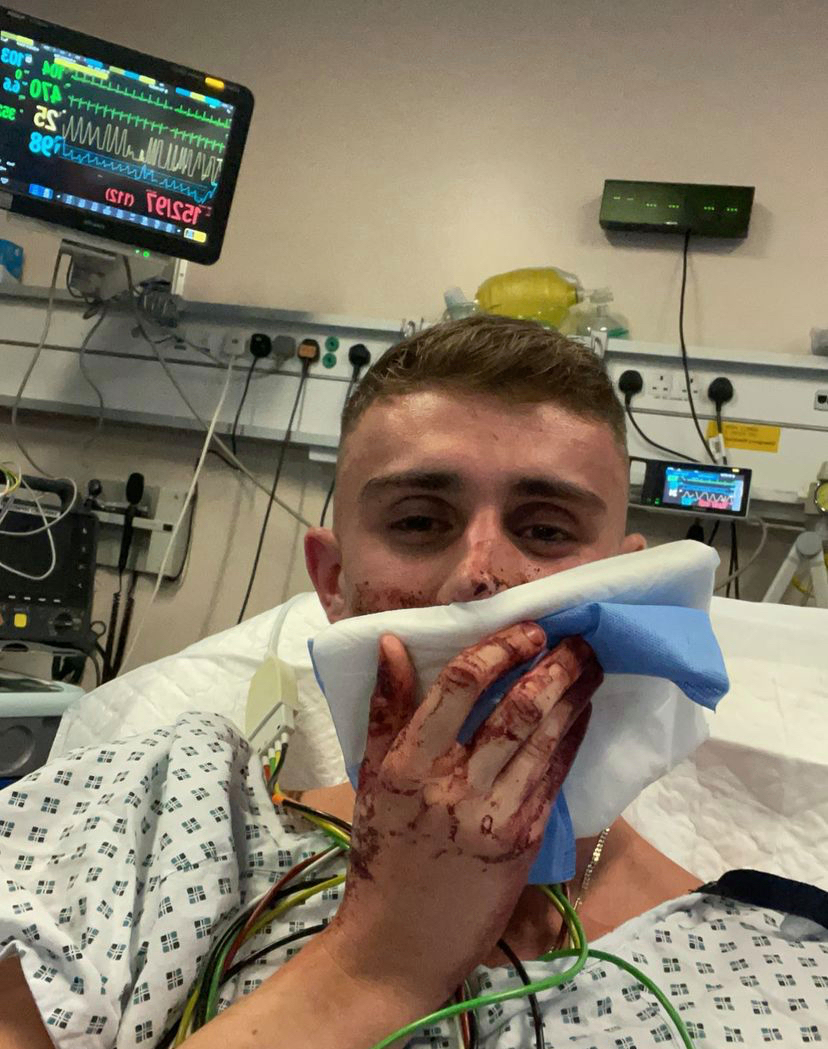 Jack Woolley, olímpico bisexual, brutalmente golpeado por 12 personas en Irlanda