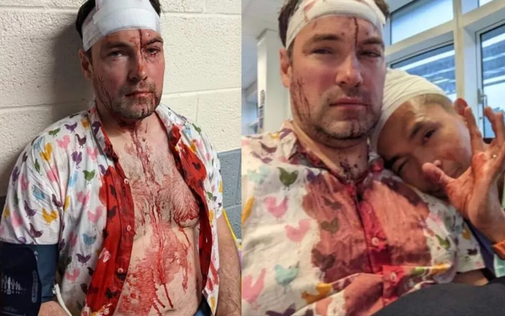 Una pareja es golpeada con botellas de vidrio en un brutal ataque homofóbico en la Villa Gay de Birmingham