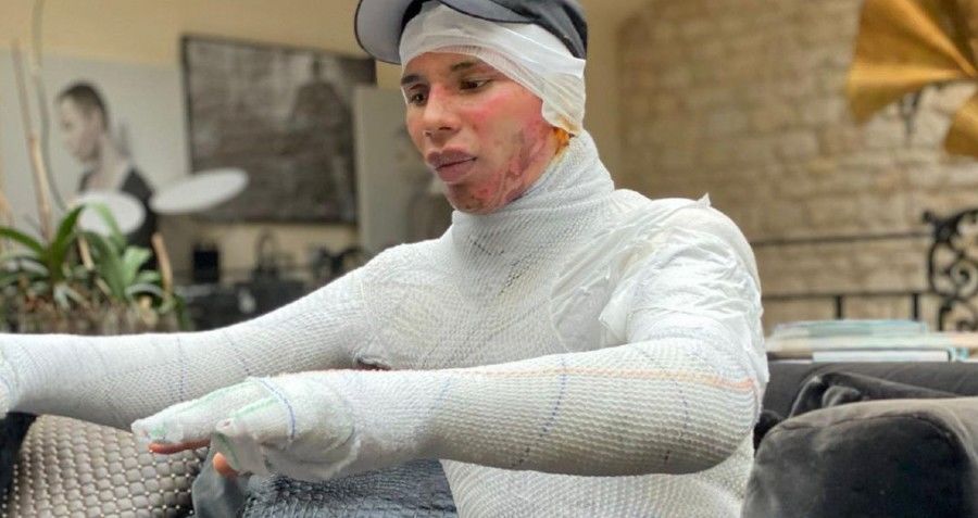 El diseñador de moda gay Olivier Rousteing sufre una explosión en su casa