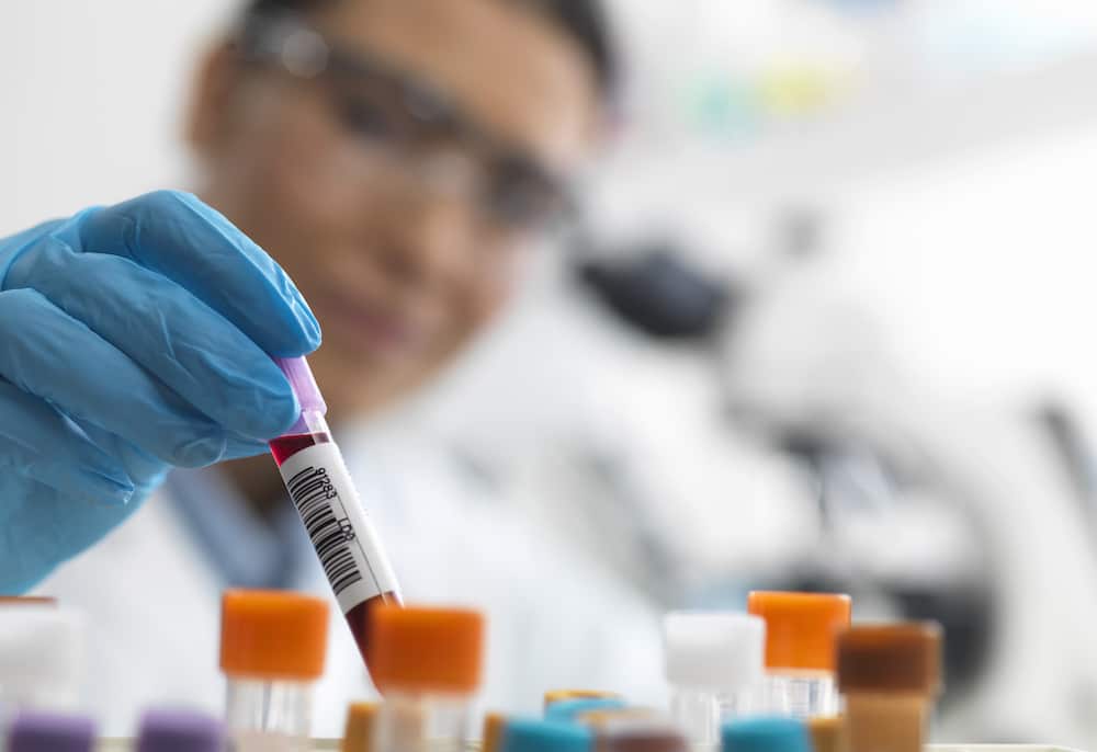 Holanda descubre una cepa más infecciona y dañina del VIH