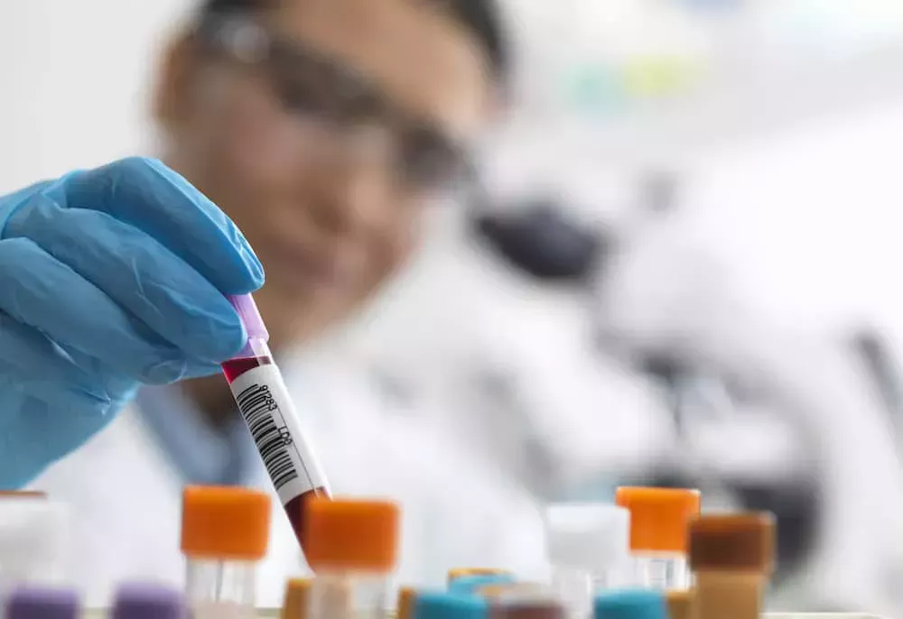 Descubierta en Holanda una nueva cepa de VIH altamente infecciosa y dañina