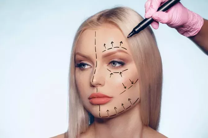 Woman whose face is marked up for plastic surgery
