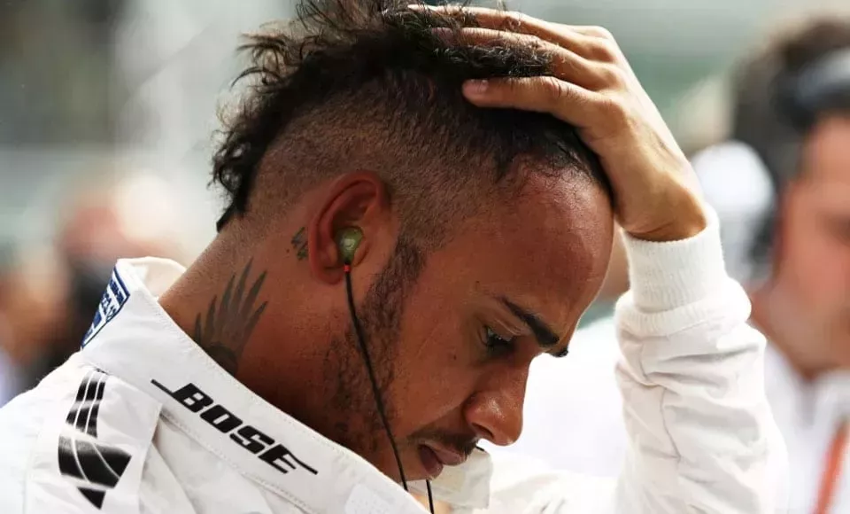 La caída del cabello no es el fin, aquí se explica cómo llevarlo cuando se está perdiendo