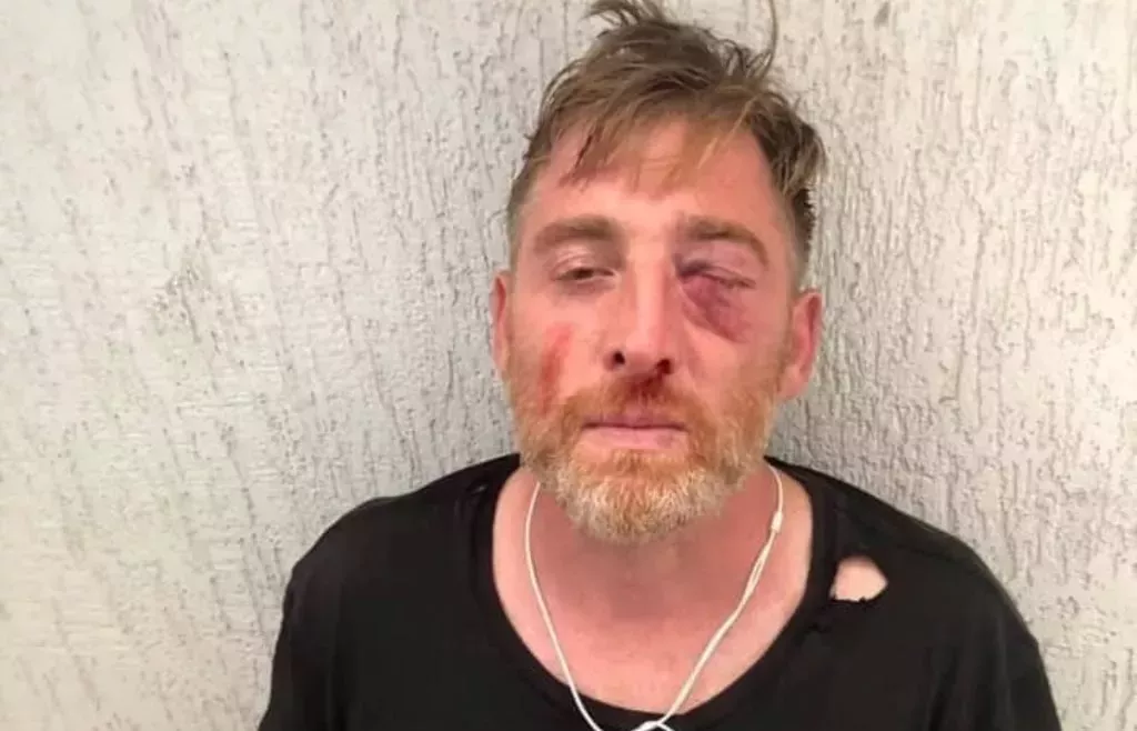 Los ataques del Orgullo de Tiflis que dejaron un camarógrafo muerto