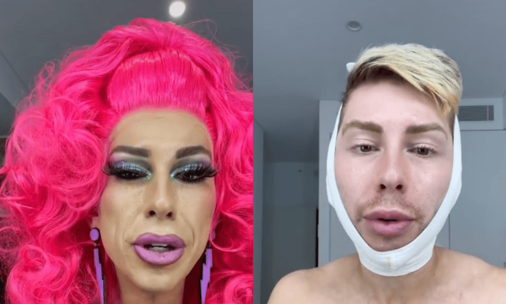 Un artista drag responde a los comentarios de odio tras hacerse un lifting