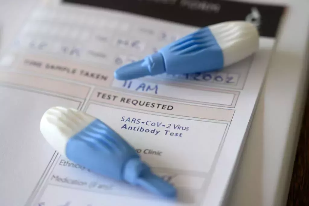 Las nuevas cifras sobre el VIH y las ITS provocan un llamamiento urgente a la acción del gobierno: 