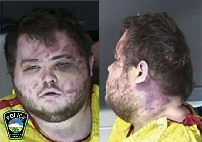 El sospechoso del tiroteo del bar gay en Colorado acusado de 305 cargos penales