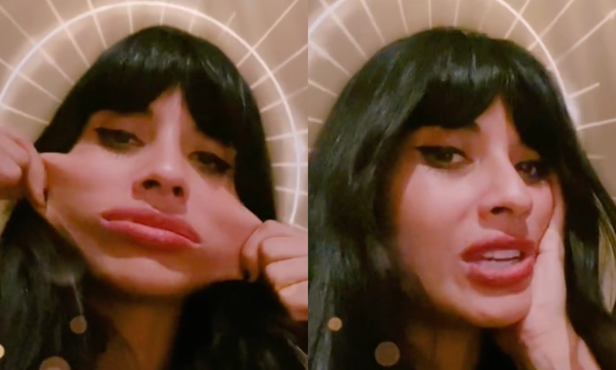 Jameela Jamil muestra una "piel elástica" al hablar del síndrome de Ehlers-Danlos