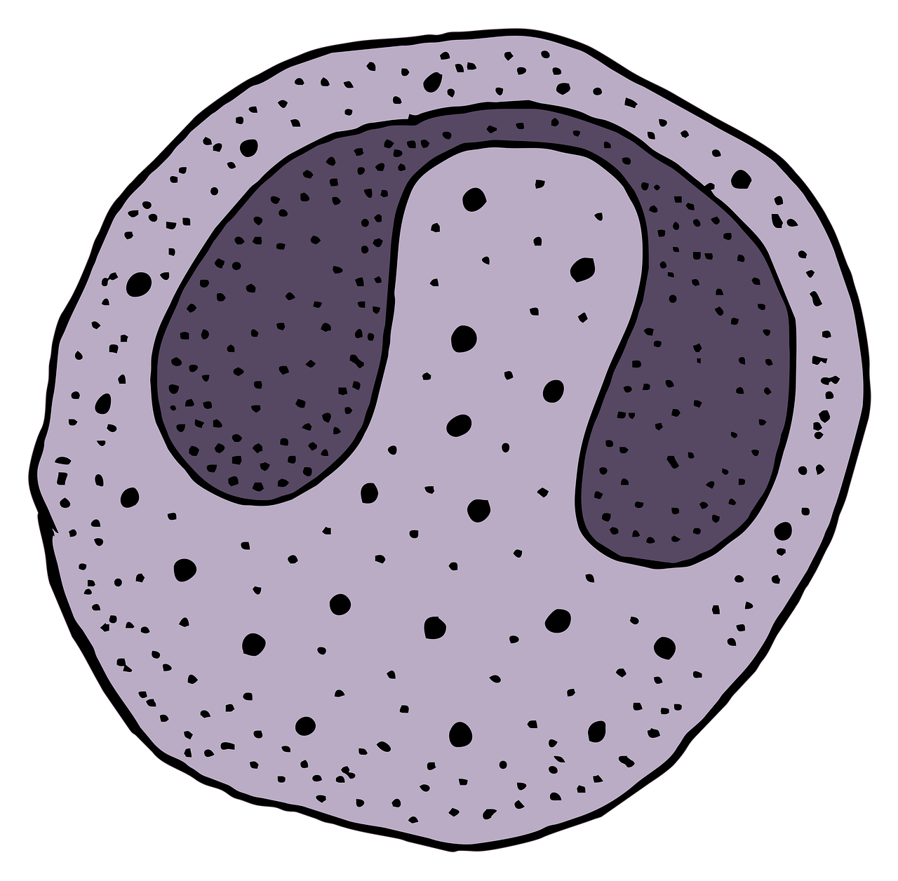 ¿Qué puede causar los glóbulos blancos altos?