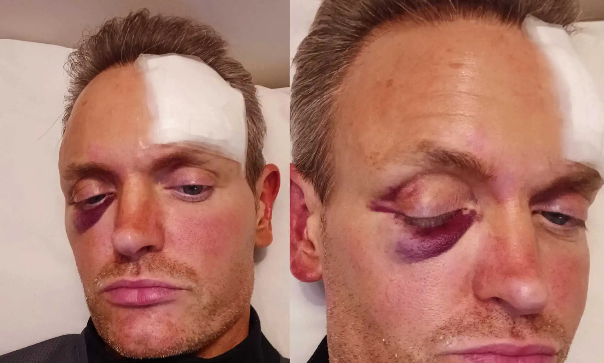 Un hombre gay golpeado brutalmente por tres hombres en un pub de Bournemouth se sintió "petrificado" durante el ataque