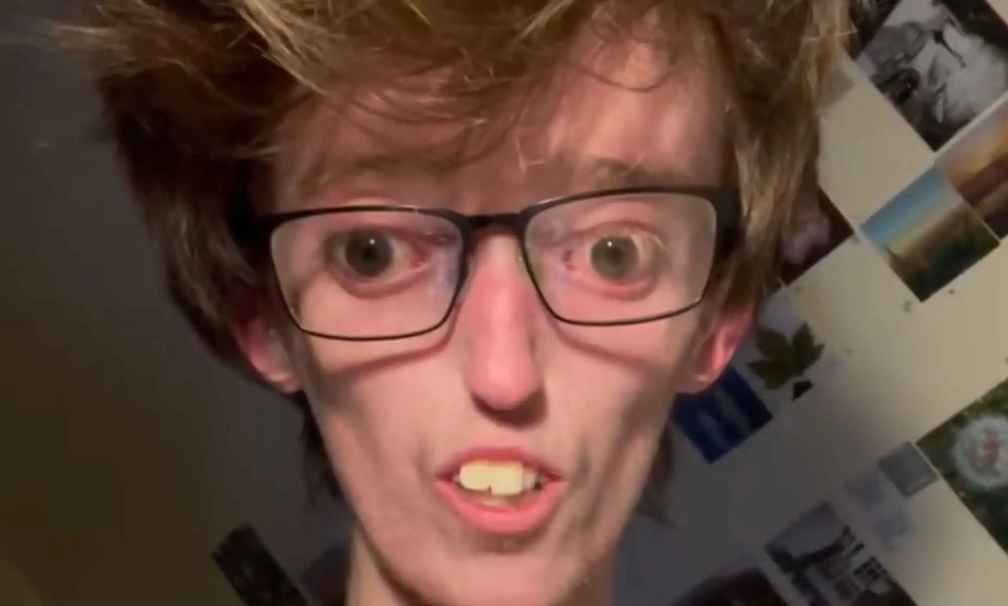 Una activista de las enfermedades raras utiliza TikTok para concienciar a la gente