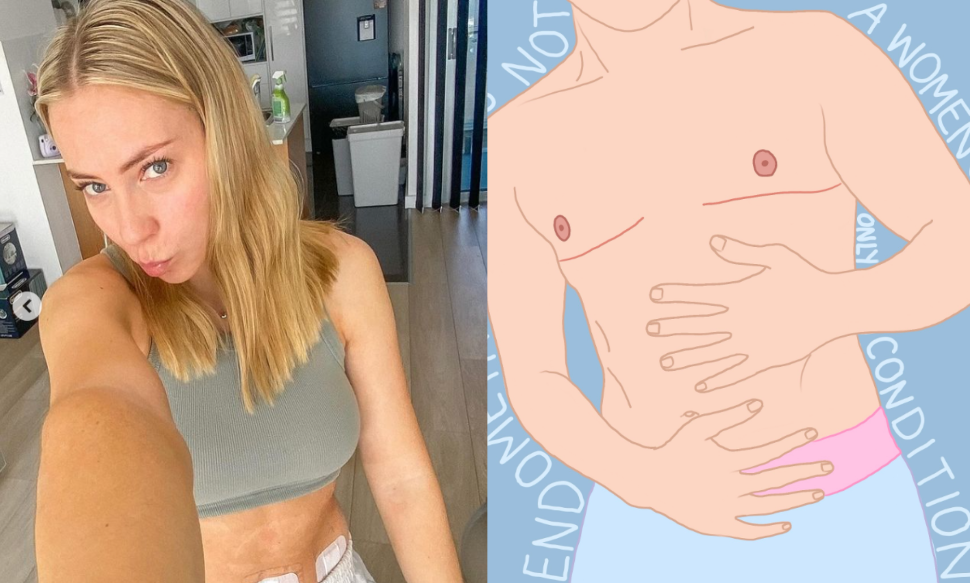 Una defensora de la endometriosis enfurece a los intolerantes con un post sobre los hombres trans que la padecen