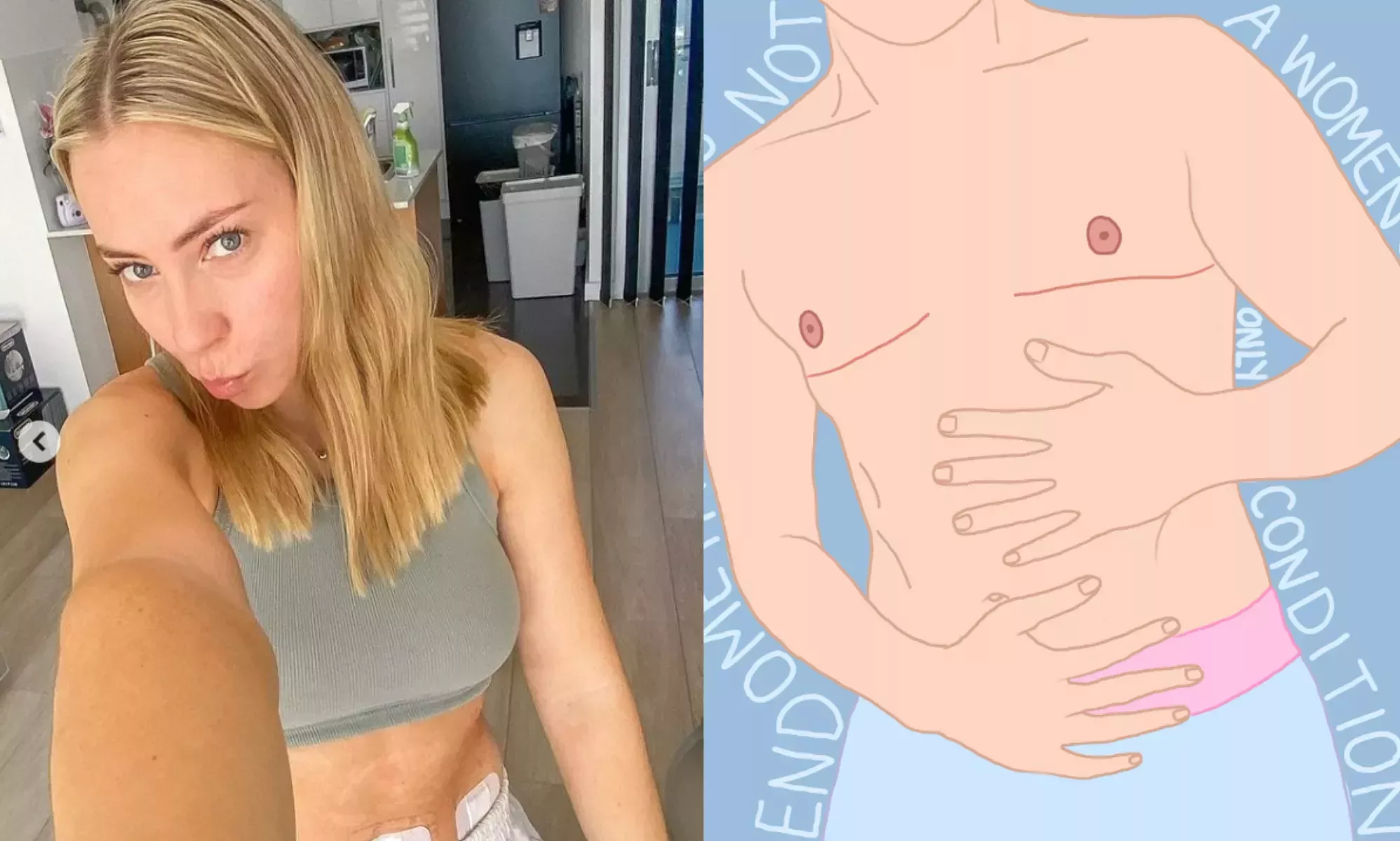 Una defensora de la endometriosis enfurece a los intolerantes con un post sobre los hombres trans que la padecen