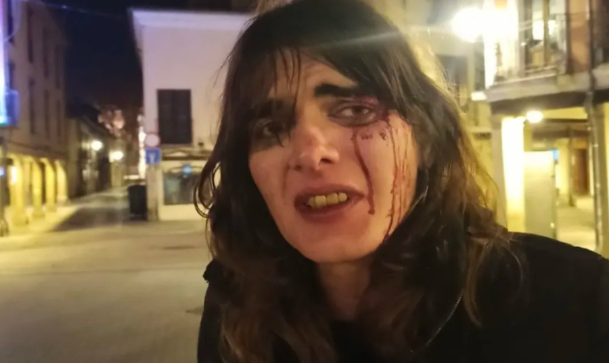 Brutal agresión transfóbica en Alcalá de Henares: dos hombres golpean a una mujer trans en pleno centro