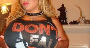 Sheyla Hershey podría perder sus dos pechos