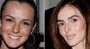 El transplante de cara de Ali Lohan, hermana de Lindsay