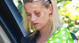 Primera foto de Reese Witherspoon tras su accidente