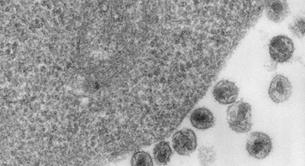 Dos personas con VIH podrían haberse curado después de un trasplante de médula