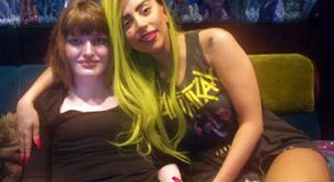 Lady Gaga se encarga de la operación de cadera de una de sus fans