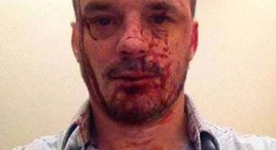 Una pareja gay víctima de un ataque homófobo pide a los políticos que no fomenten el odio