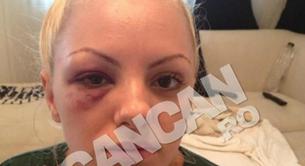 Alexandra Stan, brutalmente golpeada por su novio / mánager