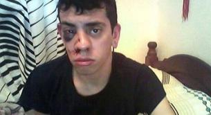 Ataque homófobo a un joven gay en Buenos Aires