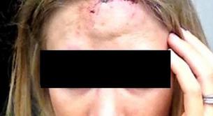 Agresión homófoba en Murcia: dos menores homosexuales apedreados