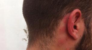 Ataque homófobo en Sevilla: paliza al grito de "ahí va el maricón"