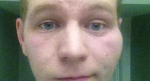 La respuesta del gay que recibió un puñetazo por besar a su novio