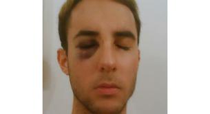 Agresión homófoba: un guarda de seguridad de Renfe ataca a un joven gay en Málaga