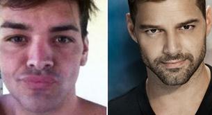 Un hombre argentino se opera para parecerse a Ricky Martin